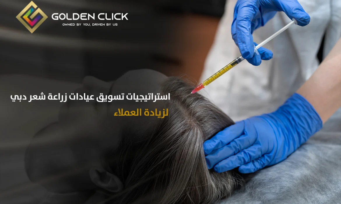 تسويق عيادة زراعة شعر دبي