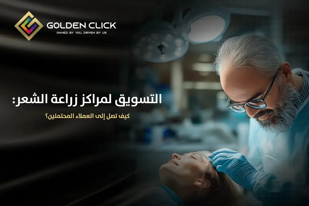 التسويق لمراكز زراعة الشعر كيف تصل إلى العملاء المحتملين؟