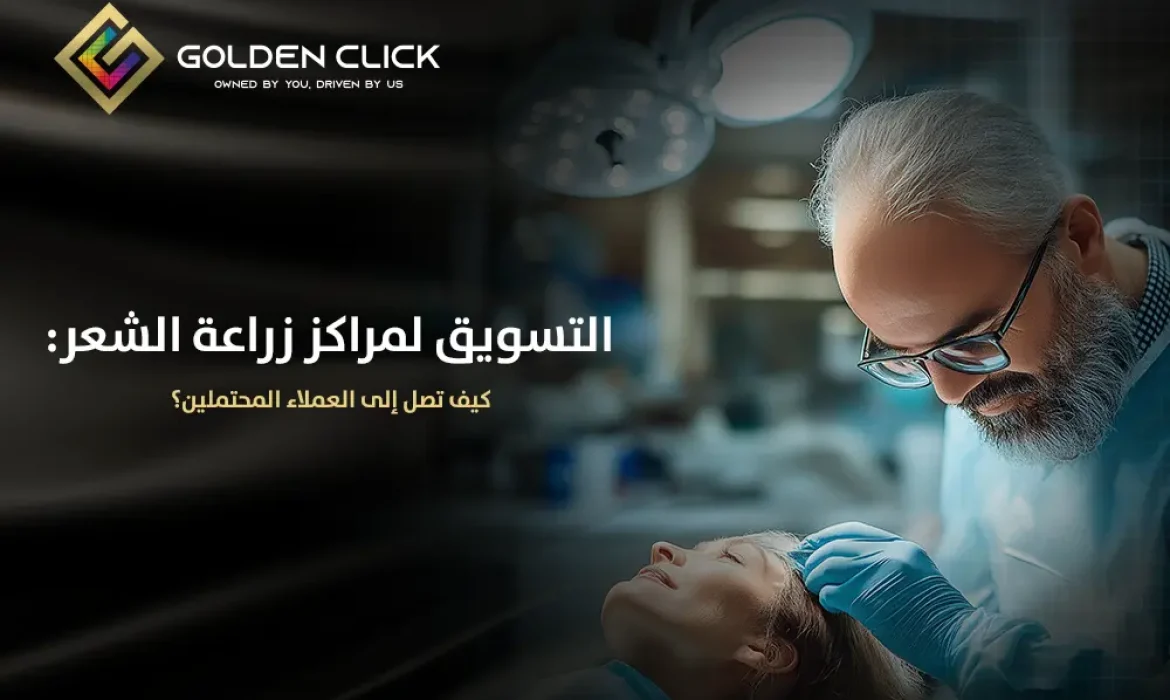 التسويق لمراكز زراعة الشعر كيف تصل إلى العملاء المحتملين؟